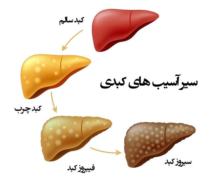 حرف های مهم فوق تخصص گوارش و کبد،مراقب باشید سیروز کبد نگیرید!! - دکتر  مهران بابایی